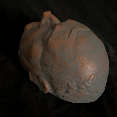 Superior view highlighting the forehead contours and upper cranial structure.